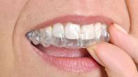 Invisalign