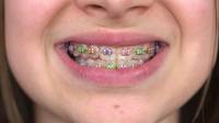 Orthodontics